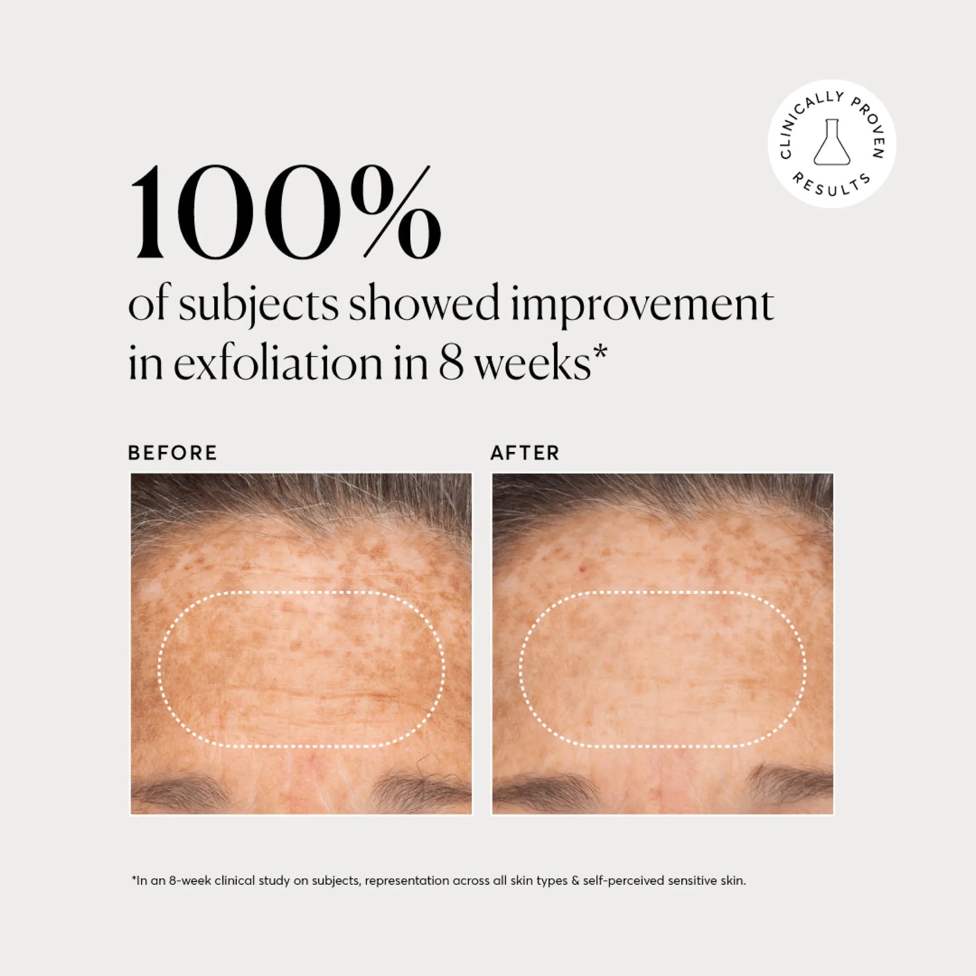 bha-liquid-exfoliant-2-r8 NATR-10027-Alt-Images-BHA-Liquid-Exfoliant-2_-03.webp